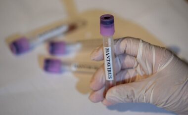 Hantavirusi/ 12 punonjës spitali izolohen pas një procedure të gabuar në trajtimin e një pacienti me hantavirus