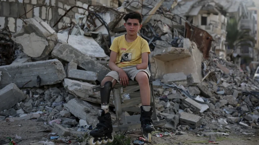 Humbi gjymtyrët në luftë/ “Kush është mëkati im?”, rrëfimi prekës i 13-vjeçarit nga Palestina